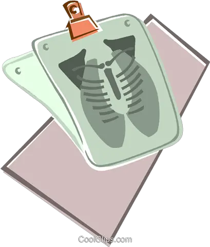  X Ray Of The Chest Royalty Free Vector Clip Art Illustration Document Png X Ray Png