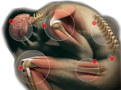  First Asco Guidelines For Chronic Pain In Cancer Survivors Congenital Analgesia Png Pain Png