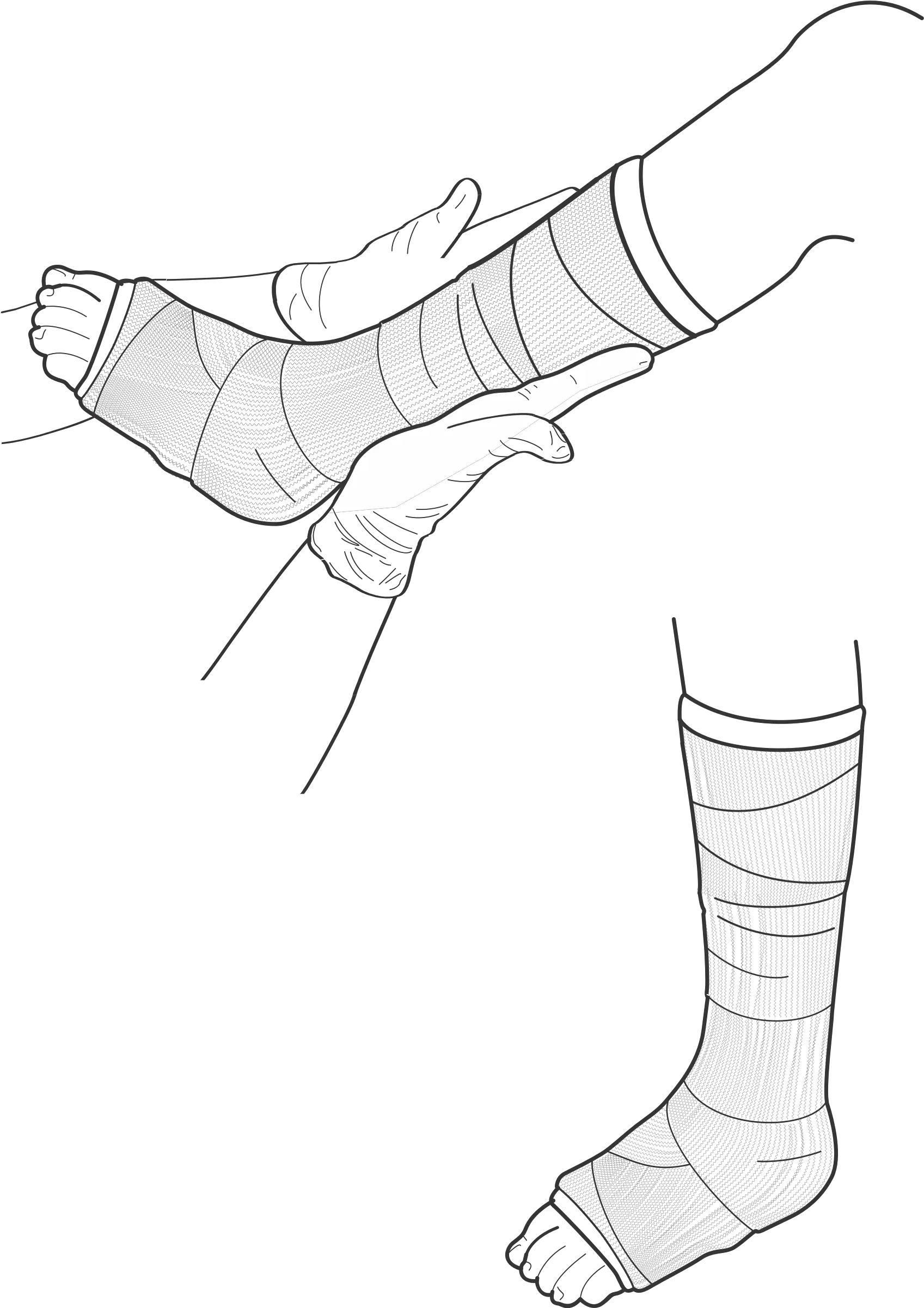  Broken Leg Drawing Drawing Of Broken Leg Png Leg Transparent