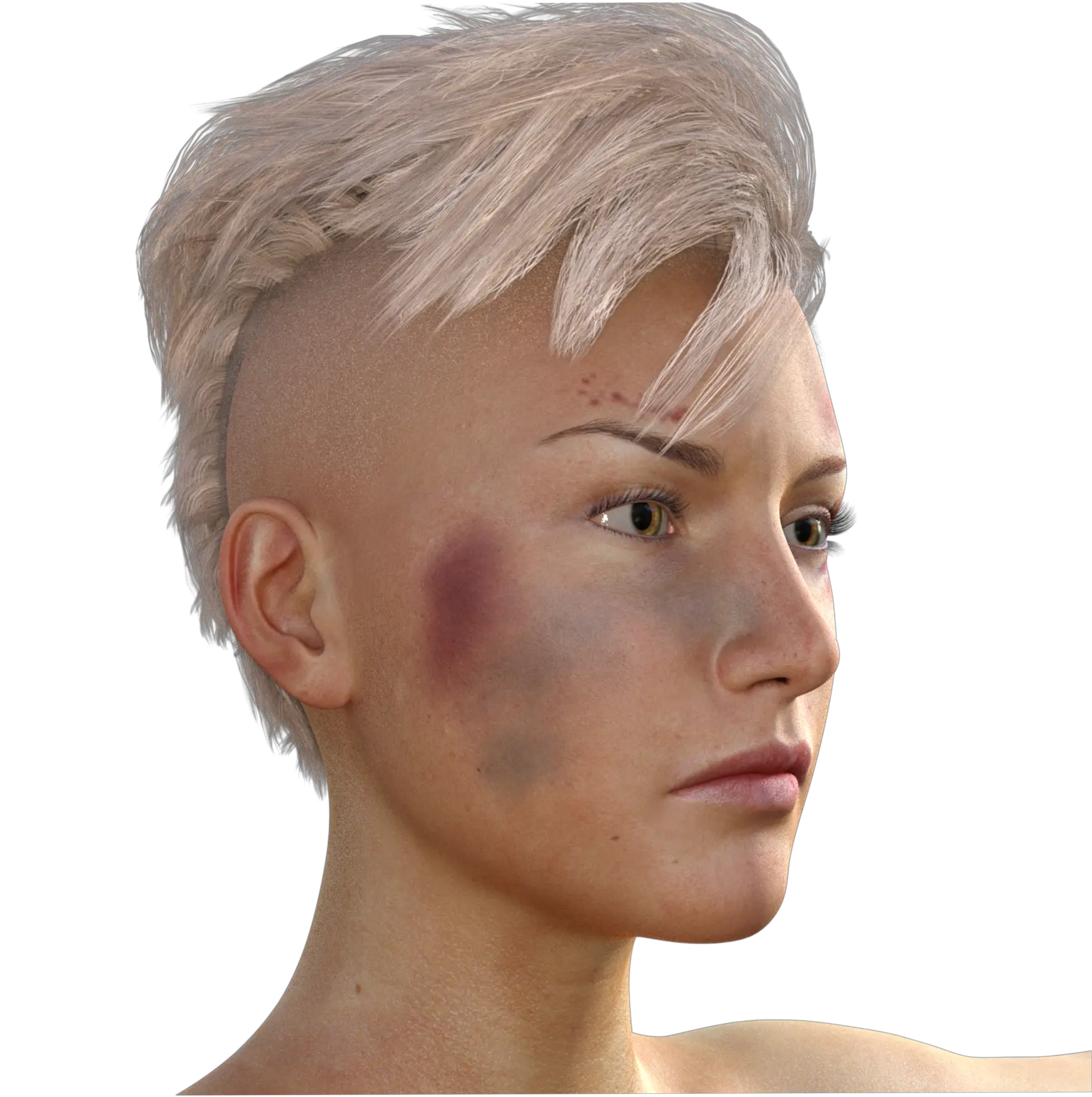  Have A Bruise And It Looks Terrible Sudden Bruising On Face Png Bruise Transparent