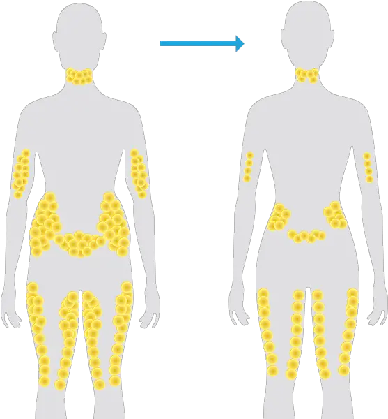  Fat Man Png Fat Cells In The Body Fat Man Png