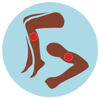  What To Know About Blood Clots If You Have Sickle Cell Massage Head Blood Clot Png Leg Pain Transparent Icon