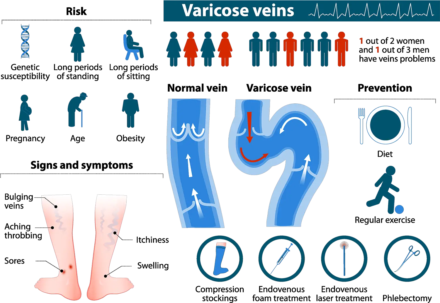  Varicose Veins Dickson Medical Associates Varicose Vein Treatment Options Png Veins Png