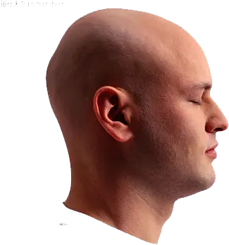  Botak Hair Loss Head Skin Man Side Face Png Download 500 Side Face Png Man Face Png