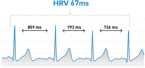  Heart Rate Variability The Ultimate Guide To Hrv Whoop Heart Rate Variability Png Heart Beat Png