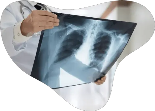  Digital X Ray Imaging Life Medical Imaging Central Coast Xray Png X Ray Png