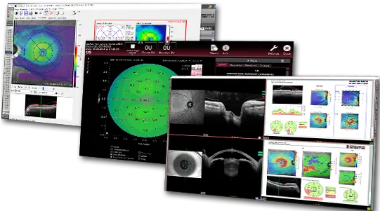  Heidelberg Eye Explorer Data That Empowers Heidelberg Heyex 2 Heidelberg Png Eye Icon On Computer