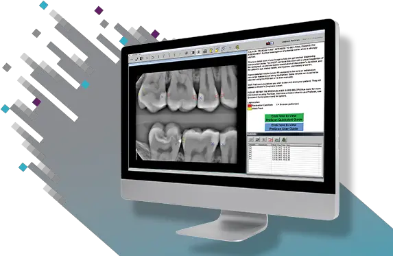  Logicon Caries Detector Software Carestream Dental Rvg 6200 Png Icon Caries Infiltrant Proximal