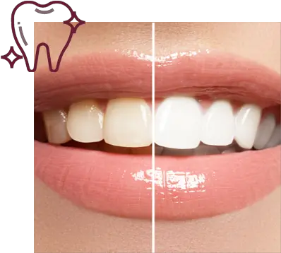  Teeth Whitening Holland Cross Dental Teeth Whitening Png Smile Teeth Png