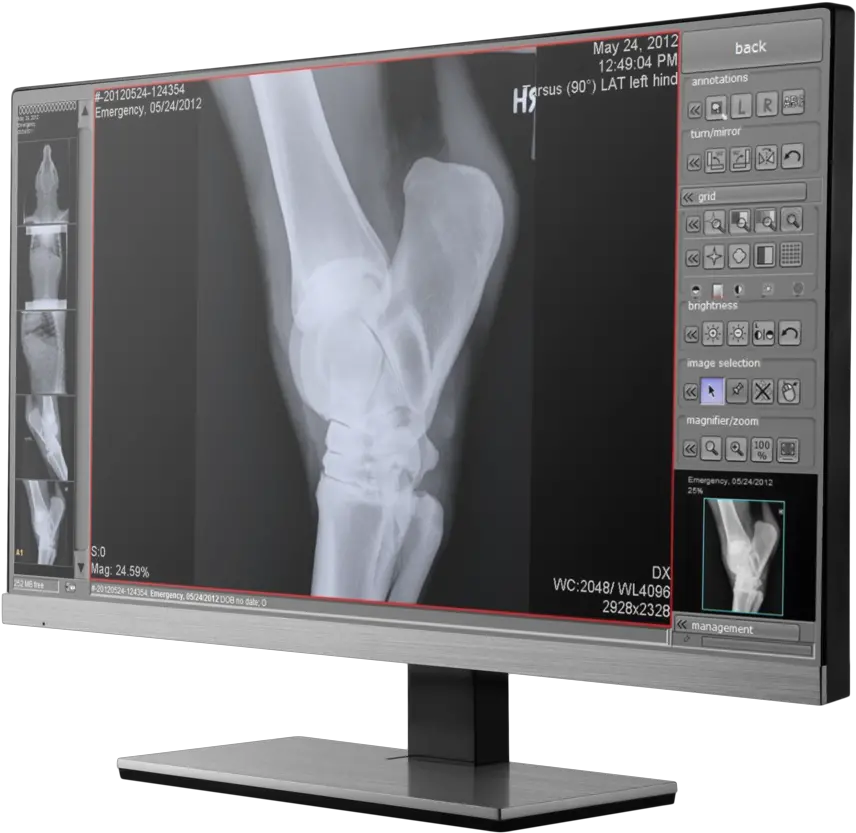  Veterinary X Ray Software U2014 Digital Xray Equipment Nuon Digital X Ray Acquisition Png X Ray Png