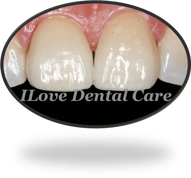  Cosmetic Dentistry U2013 Ilove Dental Care Ugly Png Cosmetic Dentistry Icon