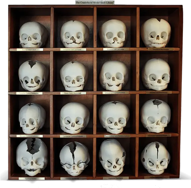  Craniofacial Model Skull Library Collection Png 3d Skull Png