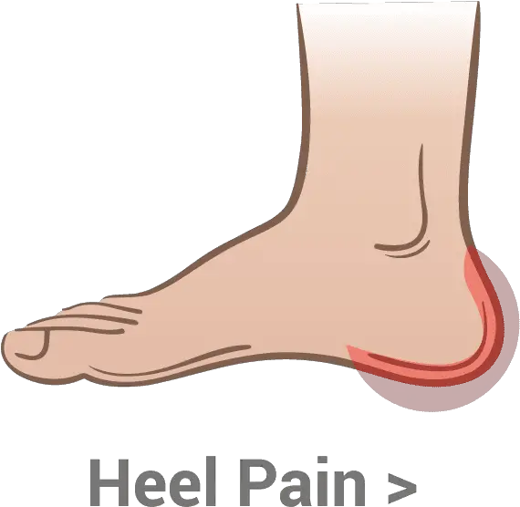  Heel Pain U2013 Kassis Brothers Shoes Ankle Png Heel Png