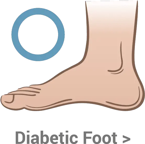  Diabetic Foot Kassis Brothers Shoes Sock Png Feet Transparent