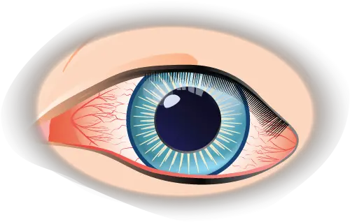  Conjunctivitis Eye Condition Treatment Dry Png Eye Wash Icon