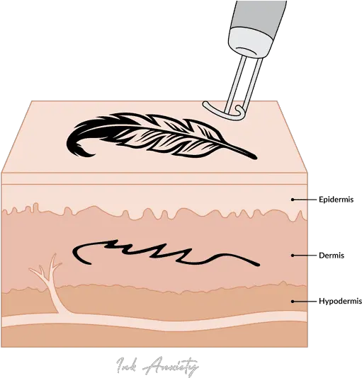  Laser Tattoo Removal Safe Treatment Precision Results Horizontal Png Tattoo Removal Icon