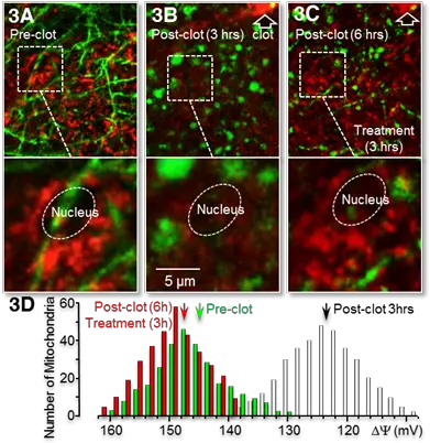  Improving Brain Cell Function Astrocyte Pharmaceuticals Graphic Design Png Mitochondria Png