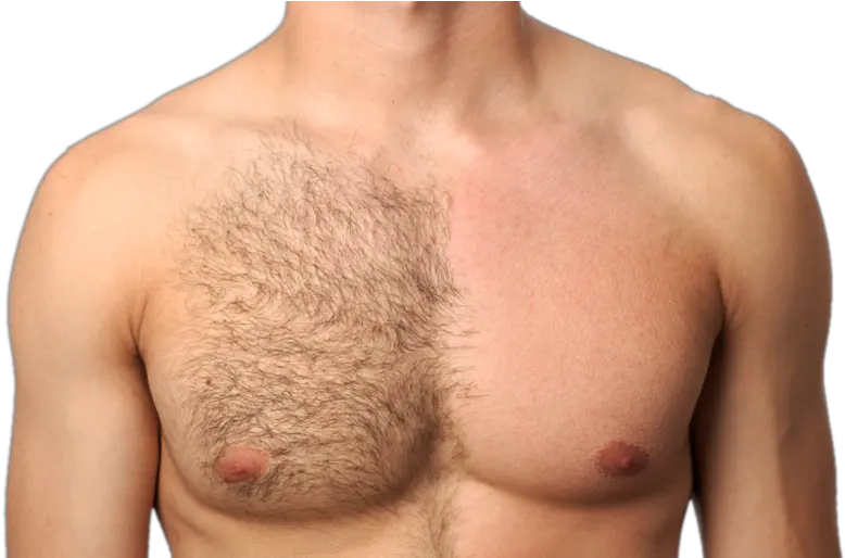  Best Hair Reduction Treatment In Bangalore And Hyderabad Men Trimming Body Hair Png Chest Hair Png