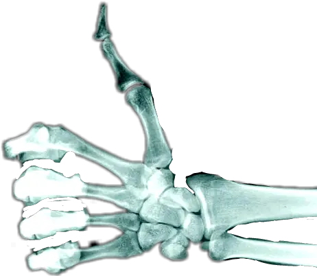  Download Skeleton Hand Thumbs Up Thumbs Up Skeleton Hand Png Skeleton Hand Png