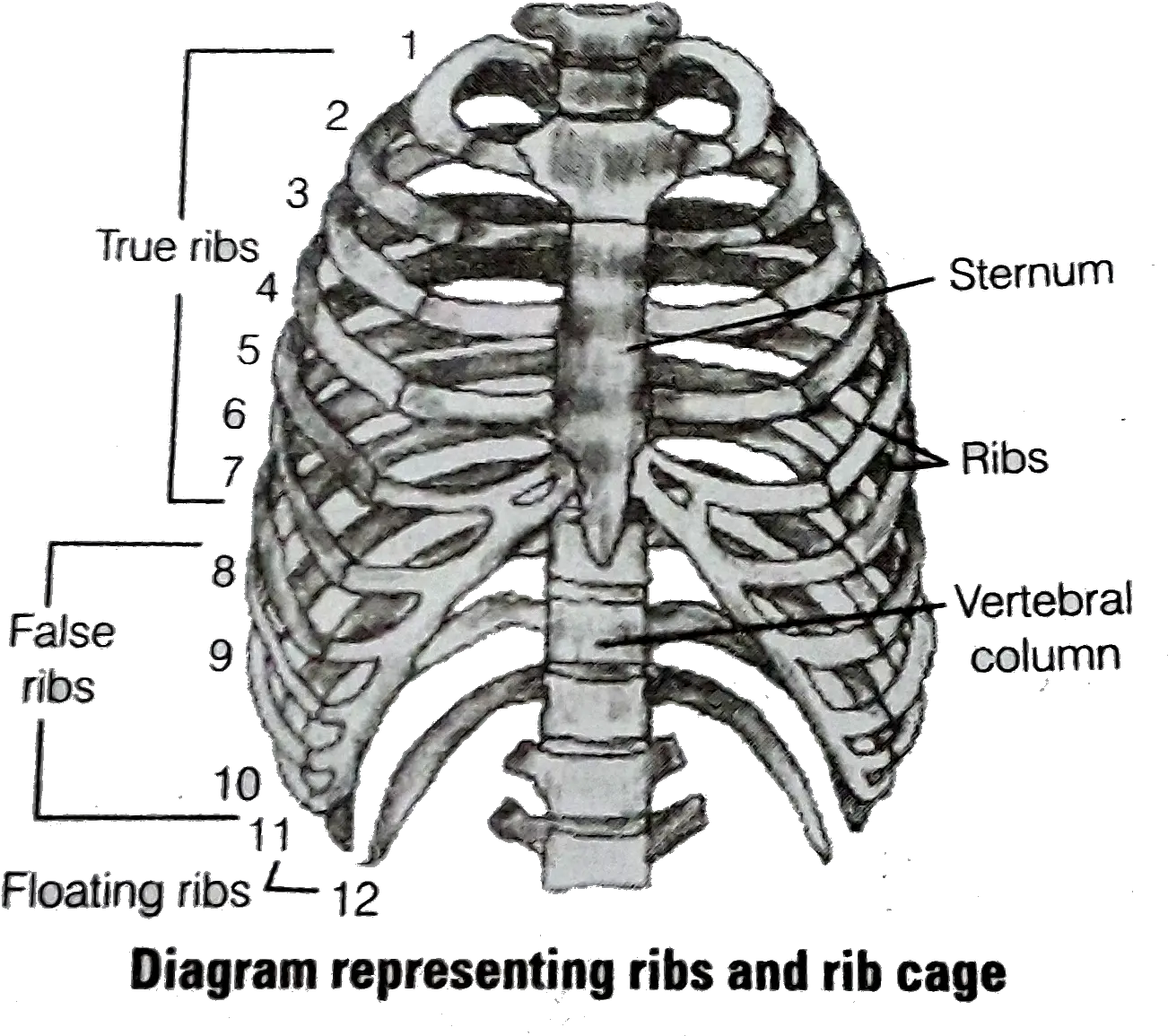  With Respect To Rib Cage Explain The Following U003cbru003e A Ribs Are Called Bicephalic Png Rib Cage Png