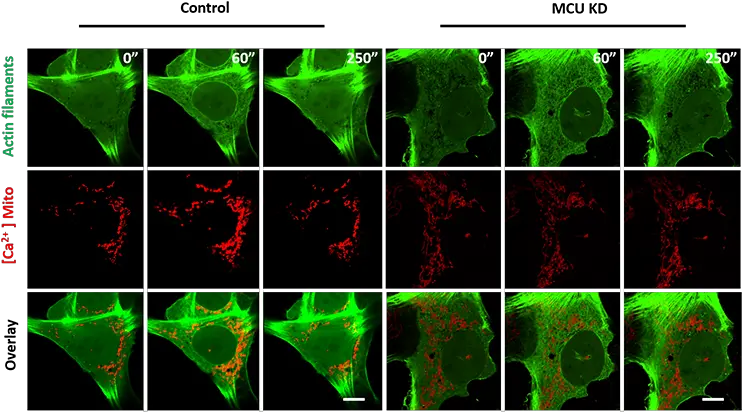  Advancing Knowledge In Mitochondria Division Using Dragonfly Graphic Design Png Mitochondria Png